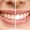 whitening